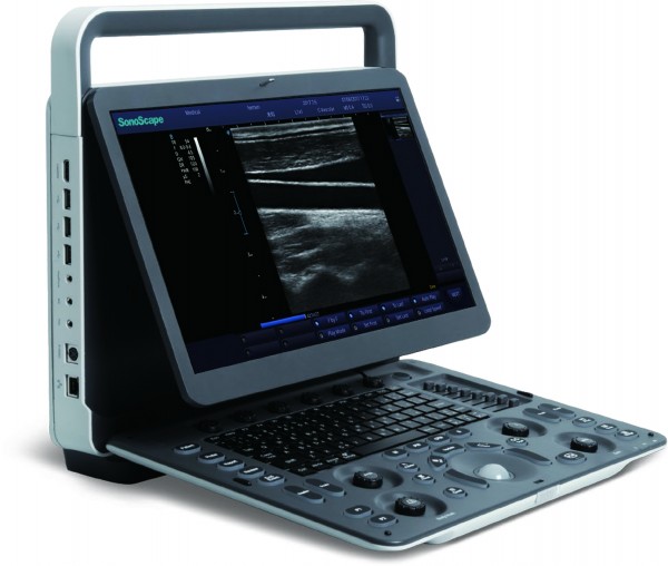 Sonoscape E1 Ultrasound Systems Veterinary Equipment Mano Medical 6497